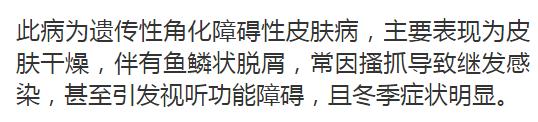 身上同时患了多种皮肤病什么原因,一到冬天全身痒怎么治