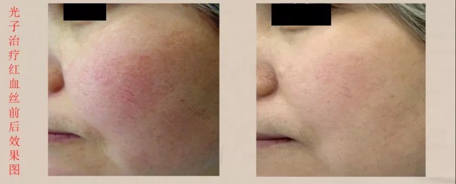 蒙自第一人民医院中医科,蒙自市中医院专家门诊