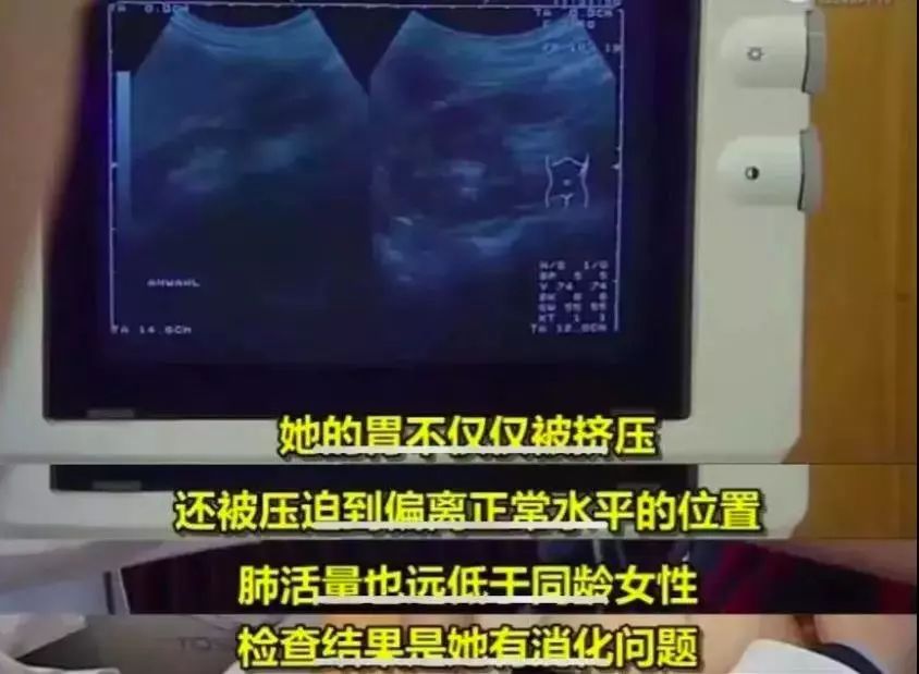 *子骗**已经盯上你了！这7种热销的「健康商品」都是大忽悠，有的还伤身