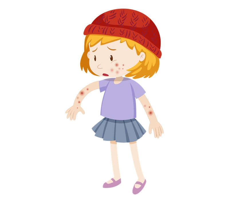 水痘高发期预防注意事项,水痘进入高发期这些坑千万要躲开