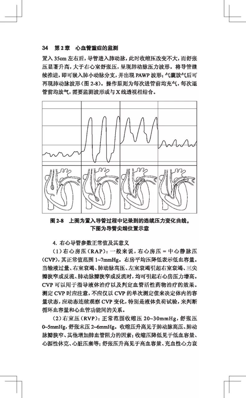 阜外医院心血管专家讲心血管视频,阜外心血管最新治疗手段