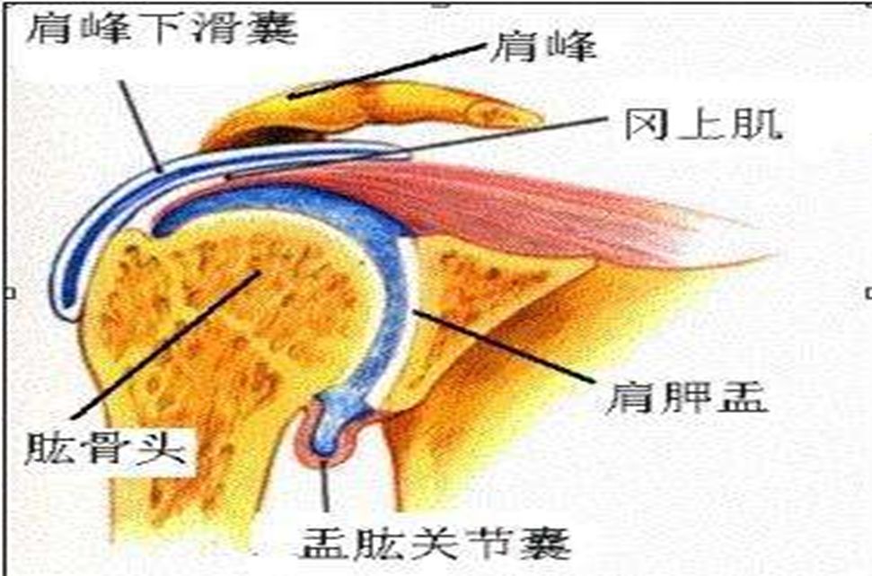 骨科科普|肩峰下撞击综合征
