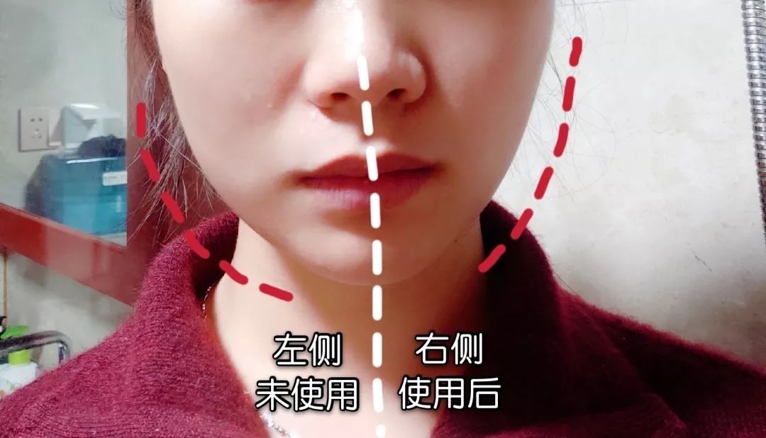 洗完脸后脸部还是能擦出脏东西,洗完脸后才知道脸上这么脏