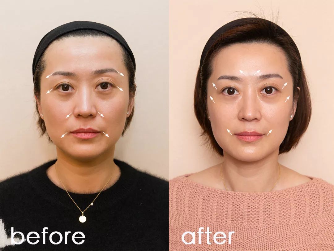 抗老三部曲紧致少女肌,抗老做好这五步hold住童颜少女肌