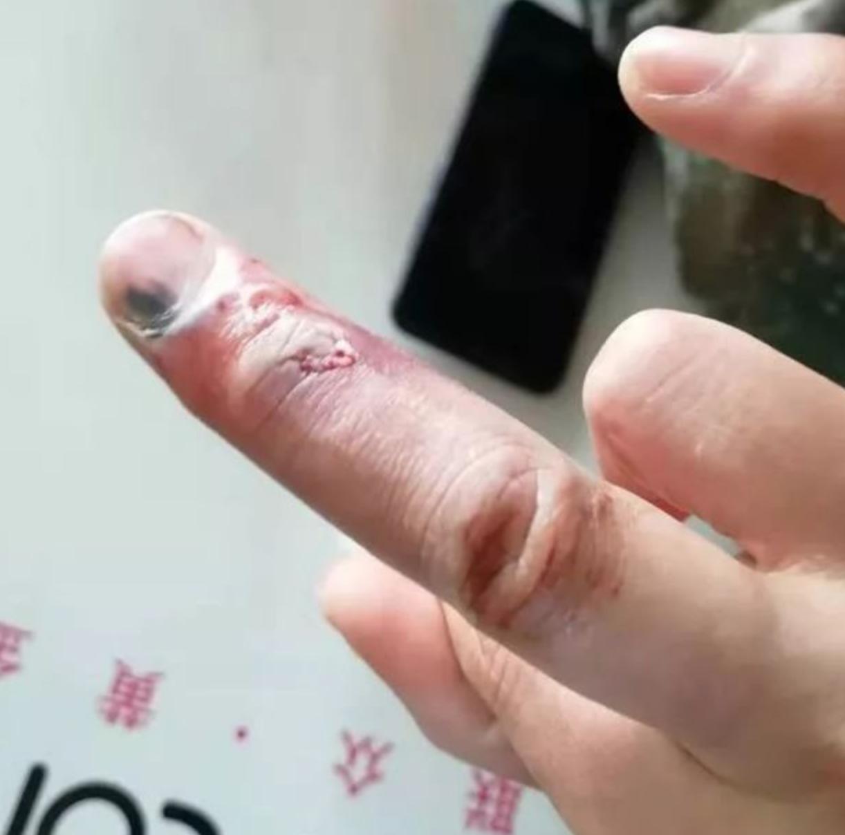 四川泸定最新疫情 (泸定最新疫情)