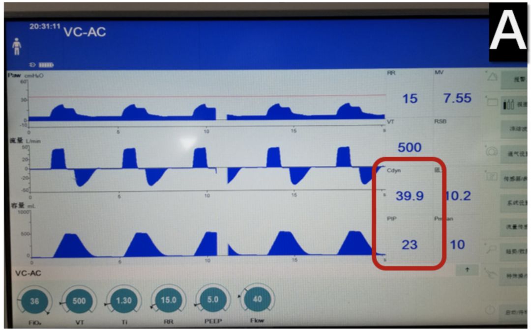 新型冠状病毒感染诊治指南,新型冠状病毒肺炎危重治疗原则