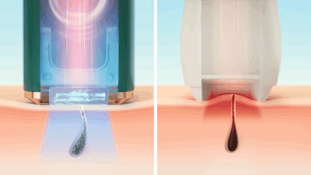 怎样才能让毛发生长越来越多呢,想脱头发怎么办