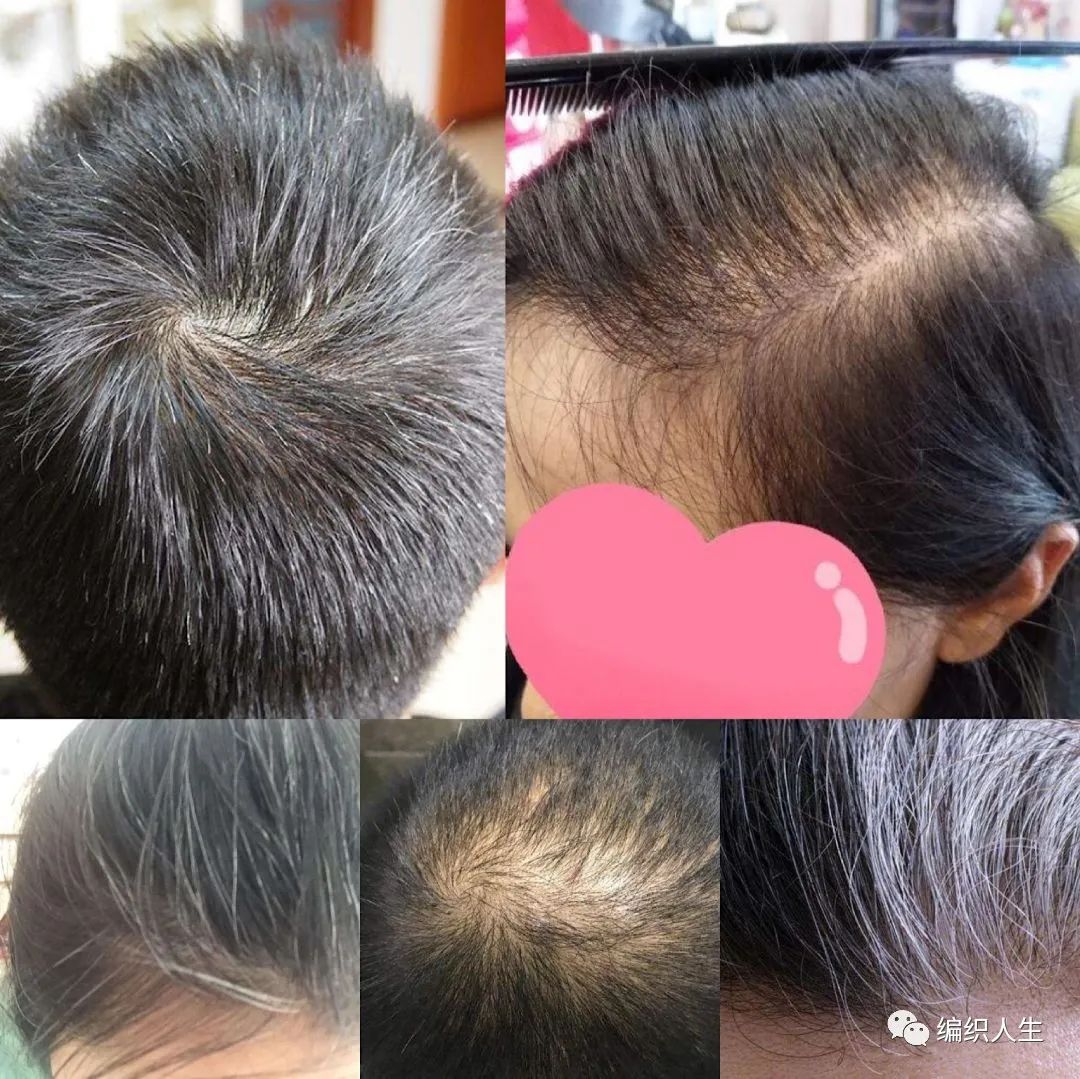 德国老太太用什么洗发水,93岁德国老太太