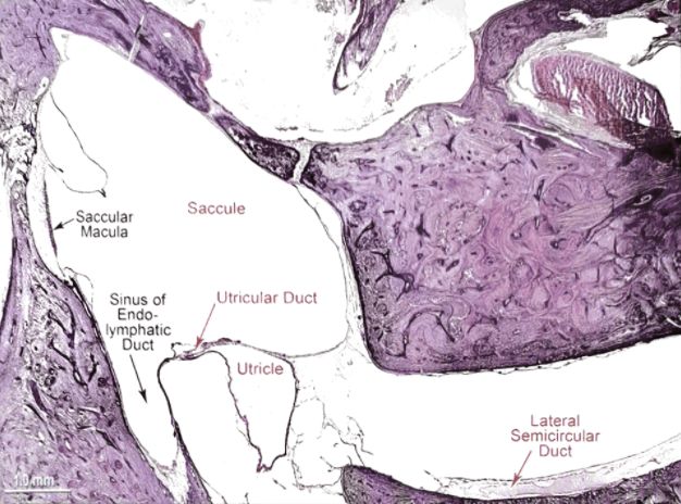 22张图，细说梅尼埃病的组织病理学特点丨“晕”筹帷幄