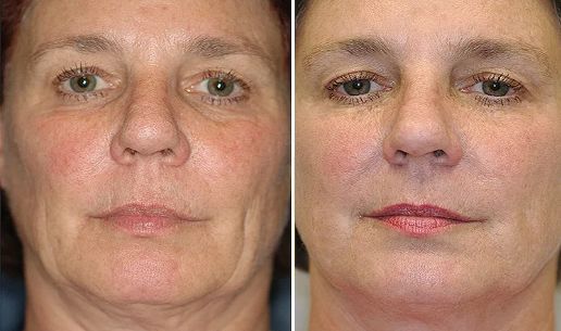 不整容不医美人真的会变吗,不整容不化妆变成美女