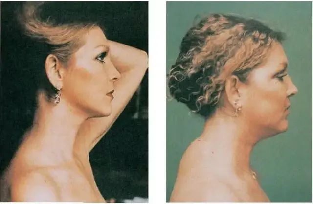 一样的体重怎么比去年更胖呢,同样体重看起来比别人胖怎么办