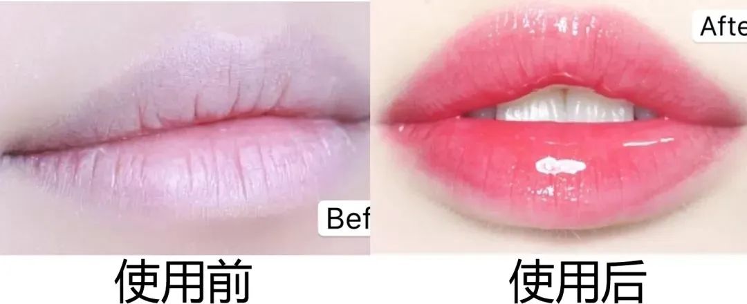 嘴唇干裂起皮等皮掉了涂唇膏,嘴唇干脱皮用什么唇部护理比较好?