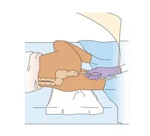 灌肠科普知识,讲一个关于灌肠的故事