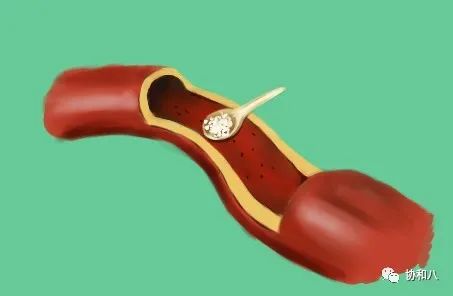 复习这些名解时总觉得怪饿的|协和八·脑洞大开