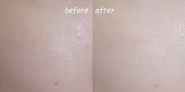 超火收毛孔*法大**！城野医生+蒂佳婷完美cp，美好价格让肌肤瞬间光滑