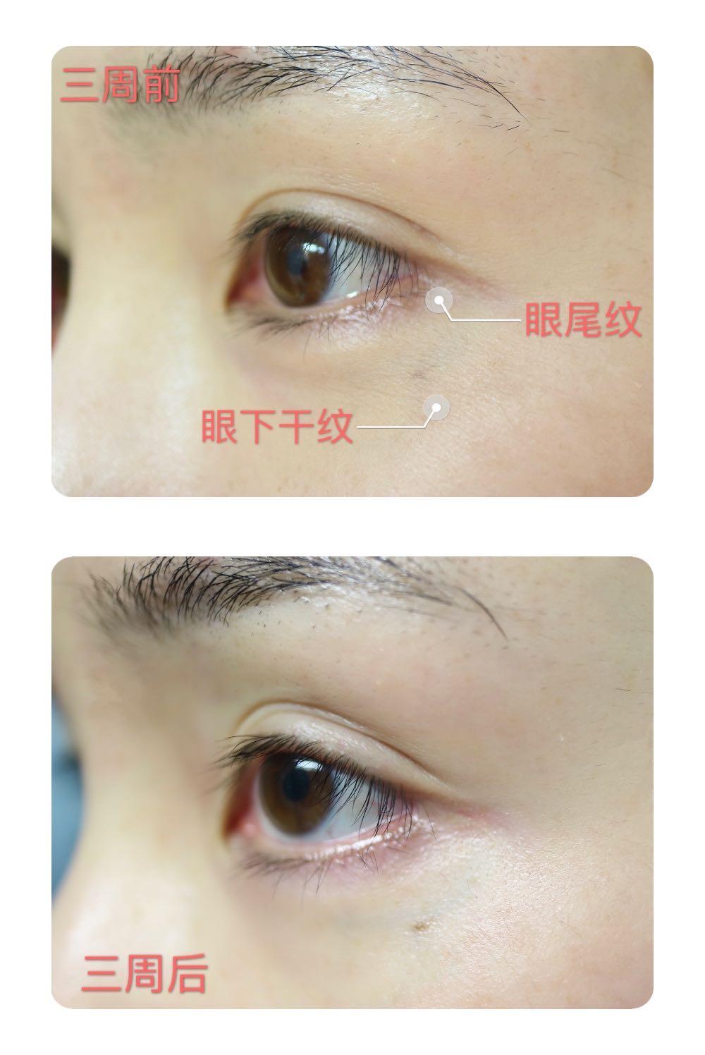 ad日本眼霜,adad眼霜