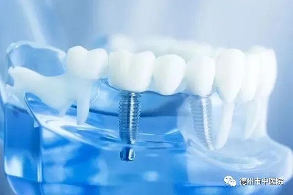 德州哪个医院种植牙比较好,德州齐河口腔医院种牙