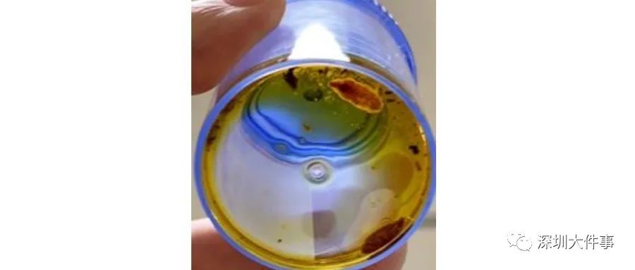 女人体内查出活虫只因一个菜,女子体内取出活虫只因爱吃