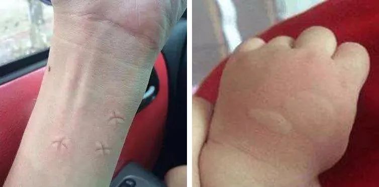 日本人真的很会玩吗,日本最好的防蚊方法