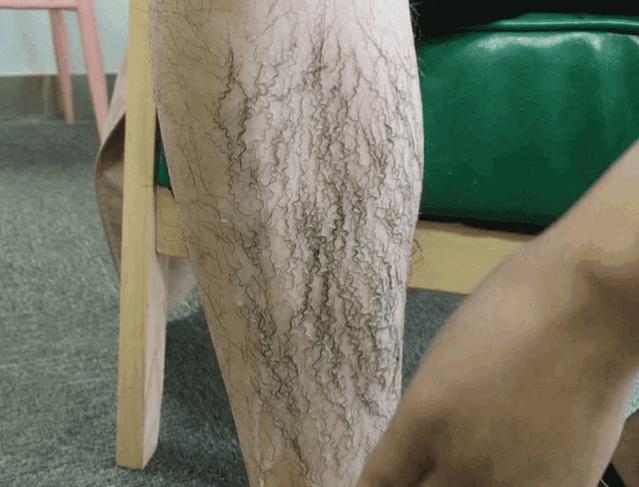 光滑无暇|黑丑的“毛裤腿”，用它，10分钟“脱”得一干二净，肌肤光滑细腻