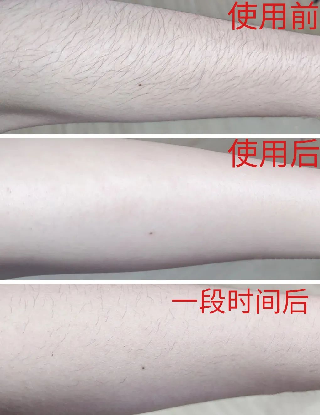 光滑无暇|黑丑的“毛裤腿”，用它，10分钟“脱”得一干二净，肌肤光滑细腻