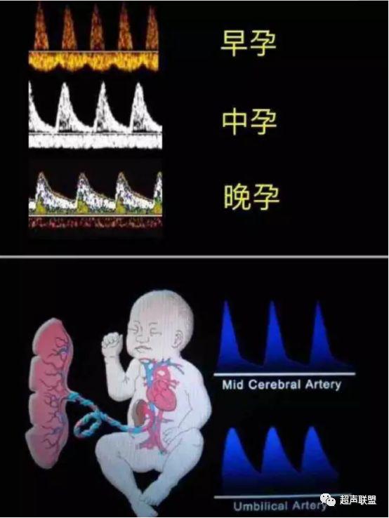 胎儿宫内窘迫如何判断,38周如何判断胎儿宫内窘迫或缺氧