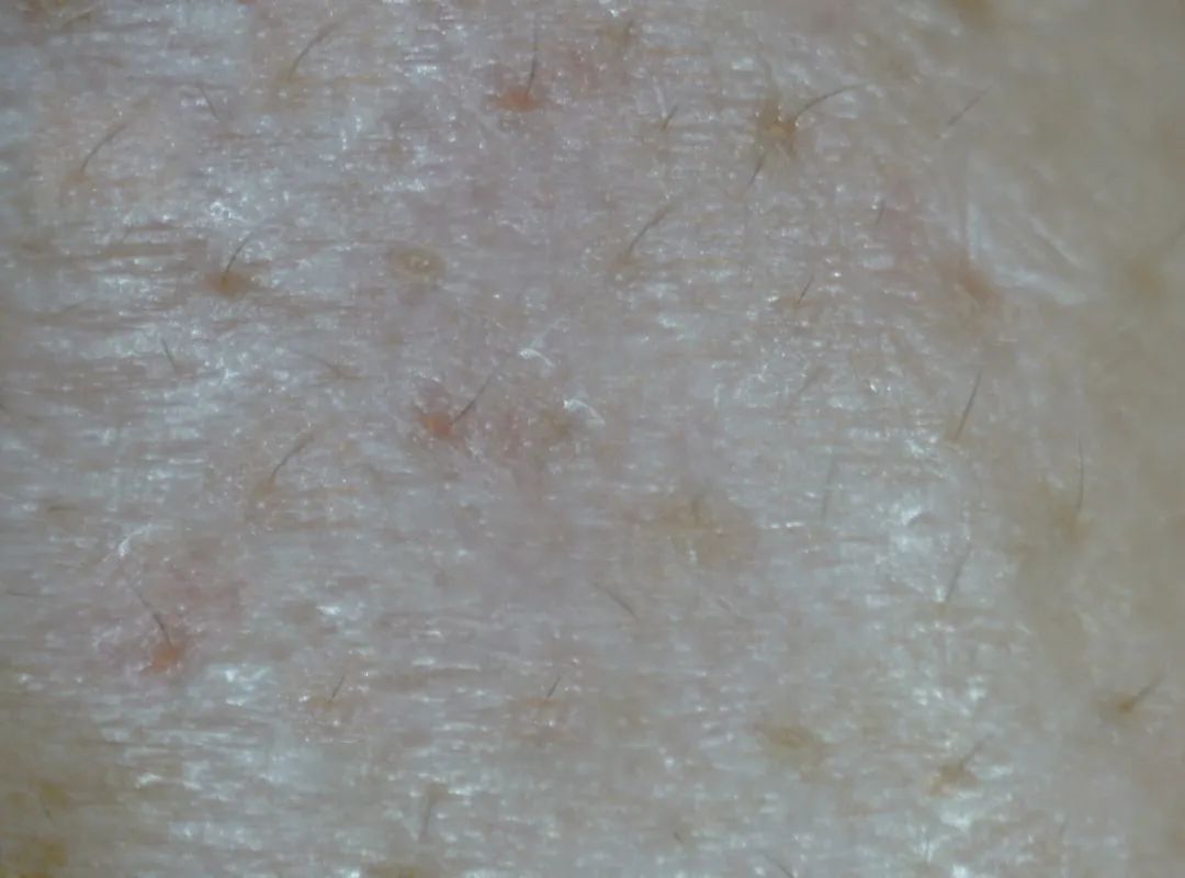 洗出脸上的脏东西解压,清除脸上斑块的产品