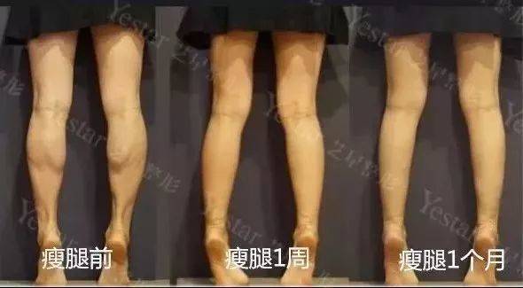 鐦﹁劯鐦﹁吙鐦﹁偐鐦﹁韩,濂界墿鎺ㄨ崘鍑忚偉鐦﹁韩鍙樼編