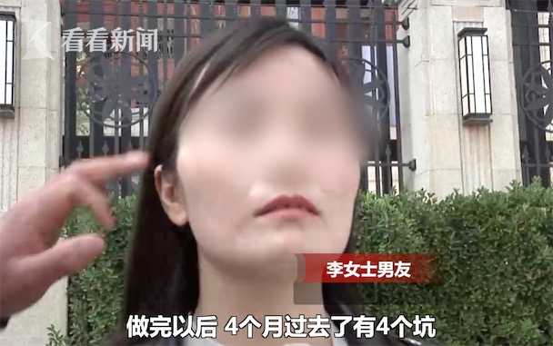 花6万块整容没想到整成这幅模样,脸太瘦整容