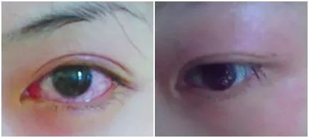 自然卷翘|比种睫毛还自然!韩国高科技假睫毛,不用胶水,一撕一贴3秒搞定,手残*党**都能秒变睫毛精