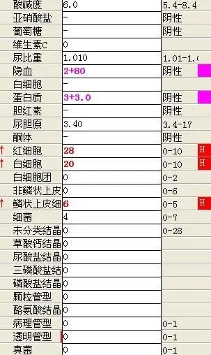 传单需要与哪些病鉴别,淋巴瘤误诊的可能性有多大