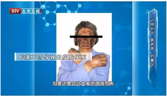 湿疹汗疱疹要注意什么,夏季皮肤湿疹注意事项