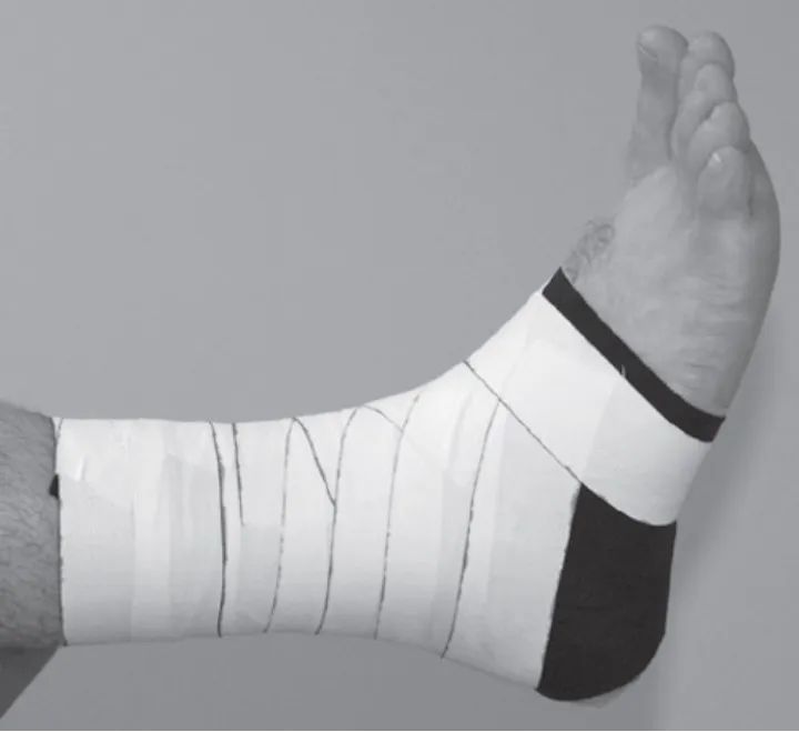 四位足球小将接连受伤！关于青少年运动损伤你必须知道……