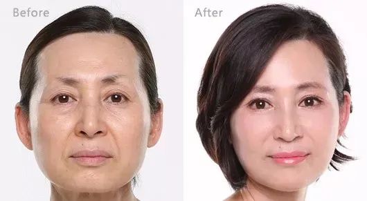 喝胶原蛋白要坚持多久才能有效果,紧急提醒经常喝这个的人要注意了