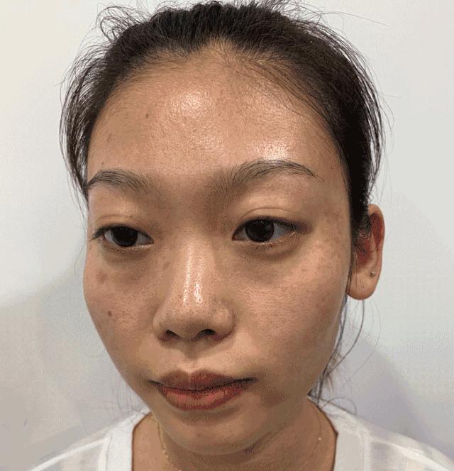 长期补充胶原蛋白的人怎么样了,长期喝胶原蛋白的人最后怎么样了