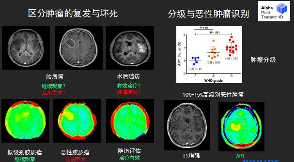 压缩时间、感知精华——西北首台3.0T光速科研型磁共振在我院投入运行