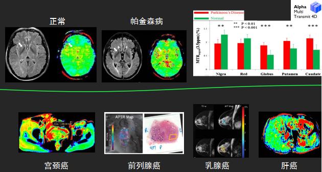 压缩时间、感知精华——西北首台3.0T光速科研型磁共振在我院投入运行