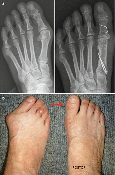 穿舒适又好看的鞋,穿好的鞋子能改善腿型吗