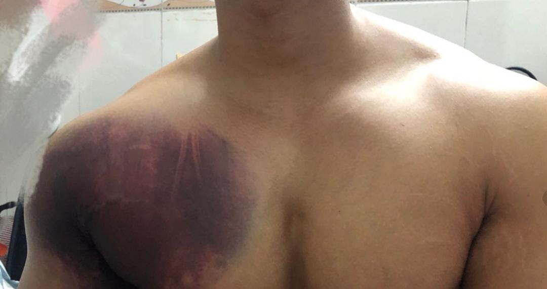 警惕一个月接诊超500例,警惕一例确诊病例