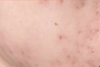 防紫外线冰袖测评,冰袖看得见肤色还遮紫外线吗