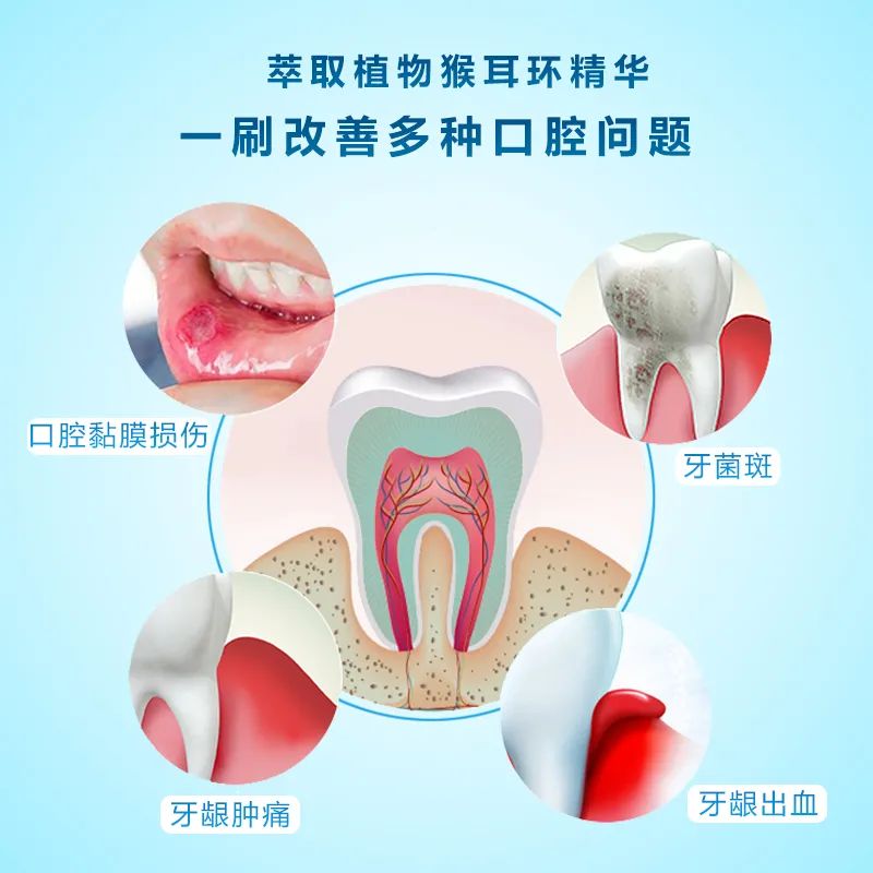 治疗口腔溃疡牙龈出血的喷雾剂,哪款中药牙膏养护牙龈