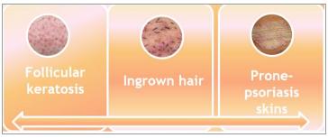 别放弃，烦人的“鸡皮疙瘩”，真的还可以再救一下