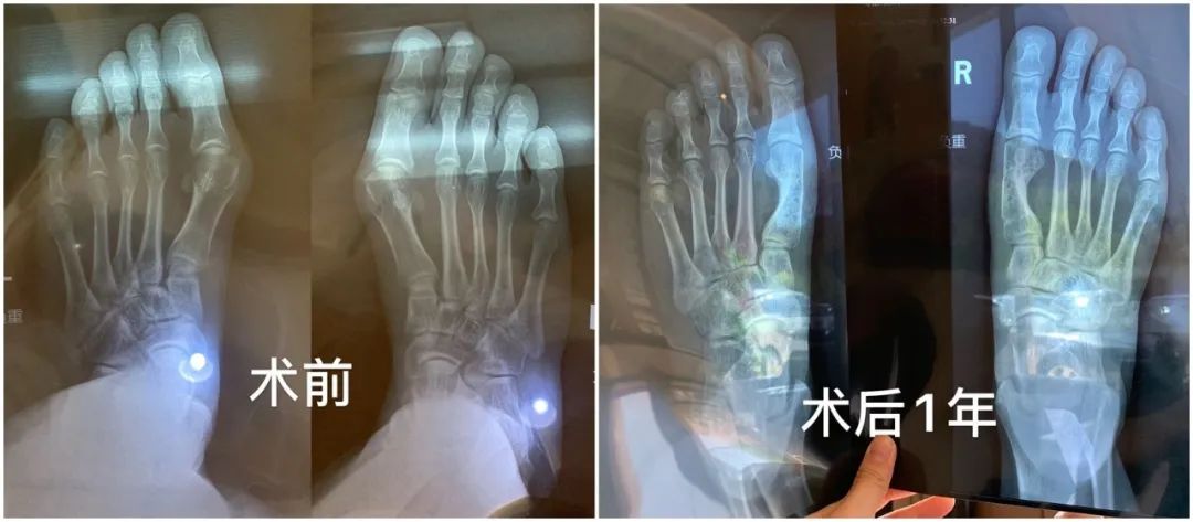 做完医美用可复美吗,你知道做完医美有多可怕