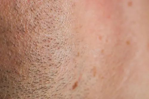 粉丝提问|为什么男人不喜欢刮胡子？