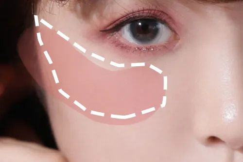 周雨彤祛痘神器,周雨彤的泪沟神器