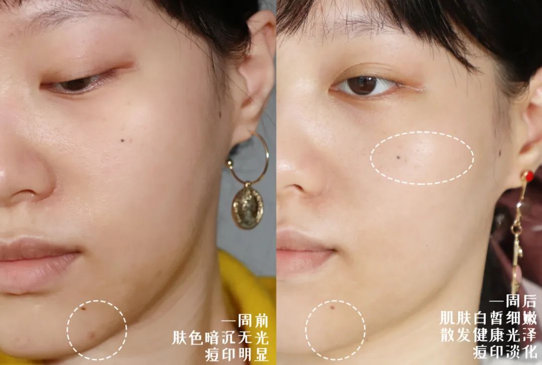 颜值逆袭瘦脸,颜值逆袭瓜子脸