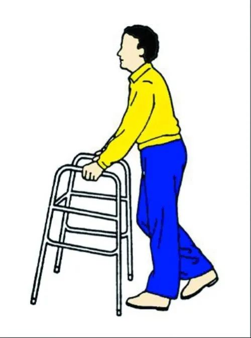 骨折后医生怎么处理,骨折后医生复位