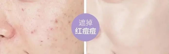 pony娴嬭瘯鐜涗附榛涗匠,pony鍖栧ザ娌瑰