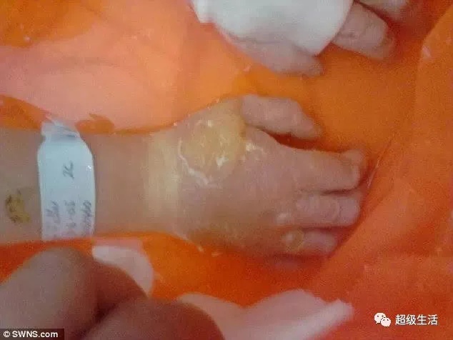 全球最毒的十大毒动物,加拿大最可怕的蛇