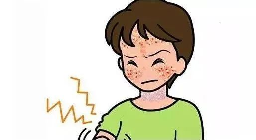 重症药疹怎么办,重症药疹患者预防感染如何护理